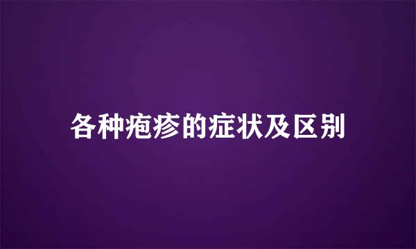 各种疱疹的症状及区别
