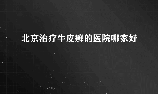 北京治疗牛皮癣的医院哪家好