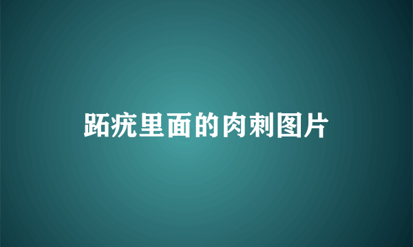 跖疣里面的肉刺图片